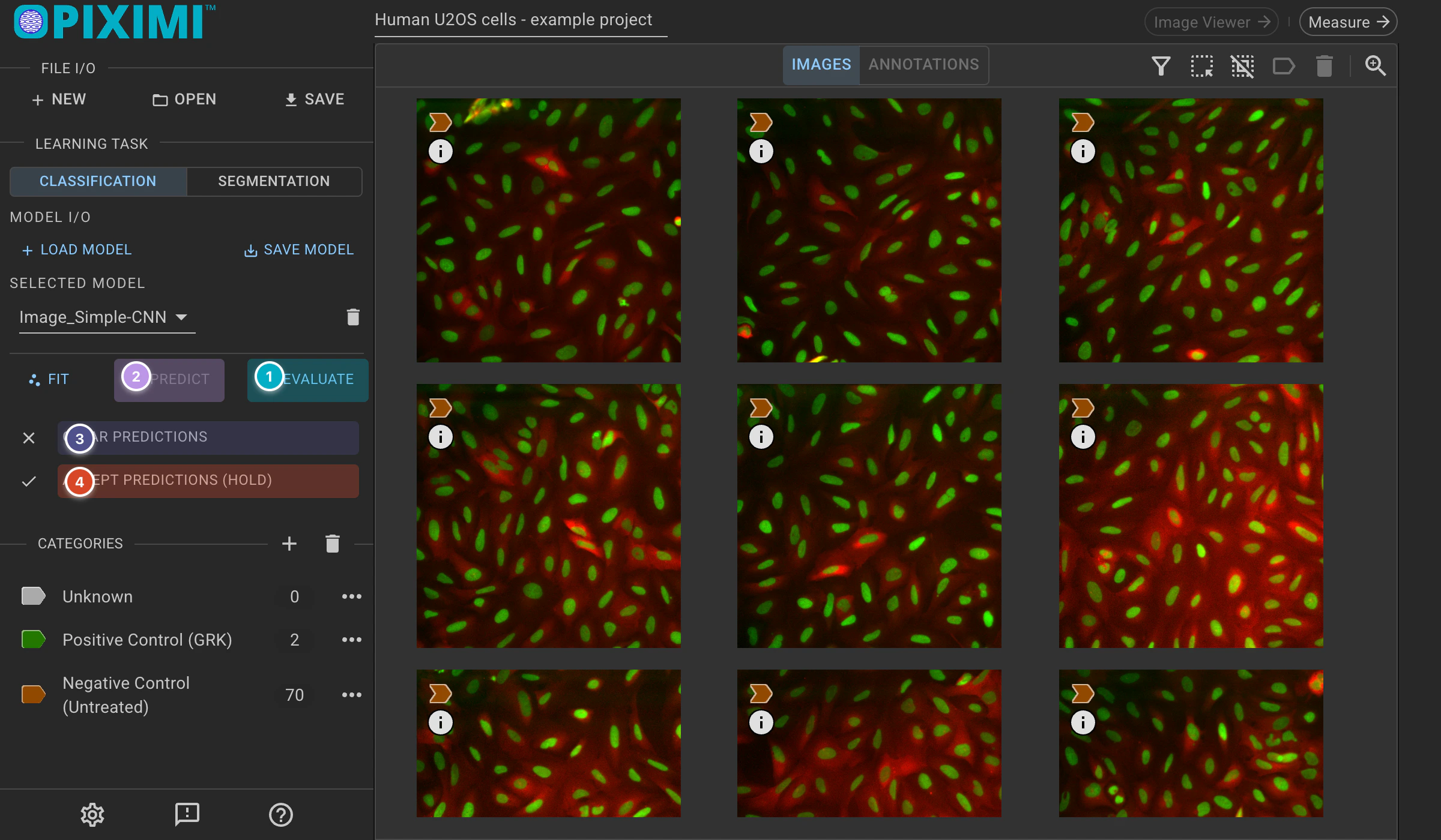 ../../_images/eukaryotic-classification-dark-predict.webp