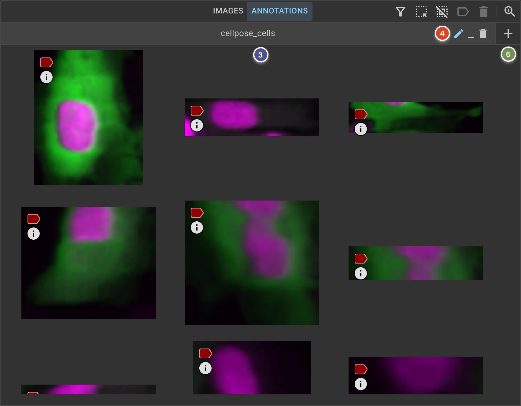 ../../_images/project-viewer-dark-maingrid-annotations.webp