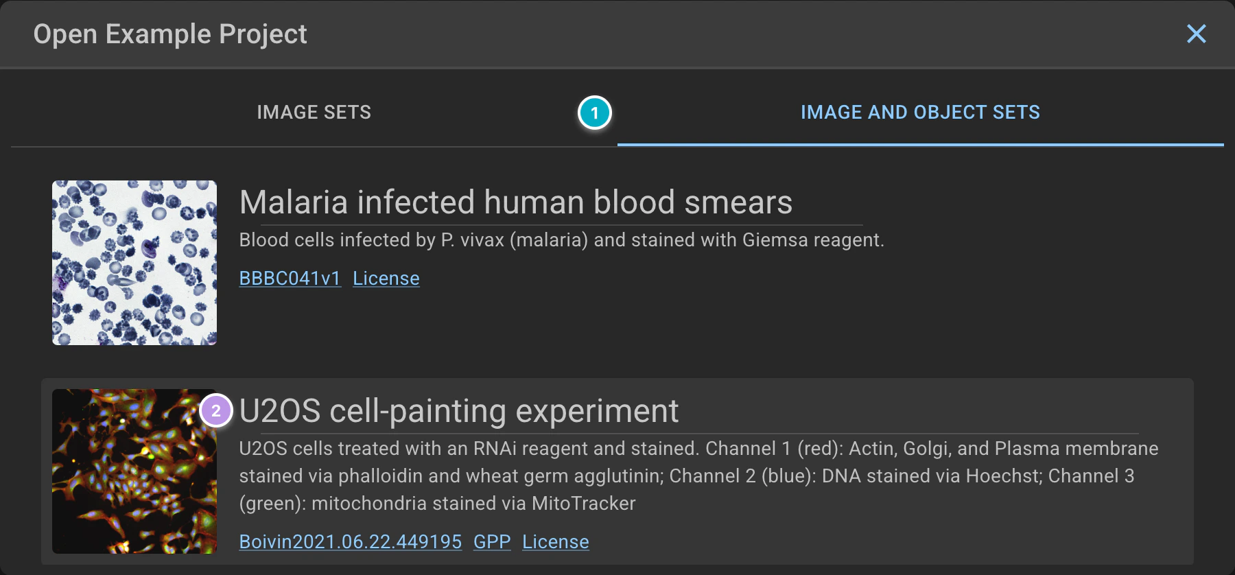 ../../_images/segmentation-tutorial-dark-open-example.webp