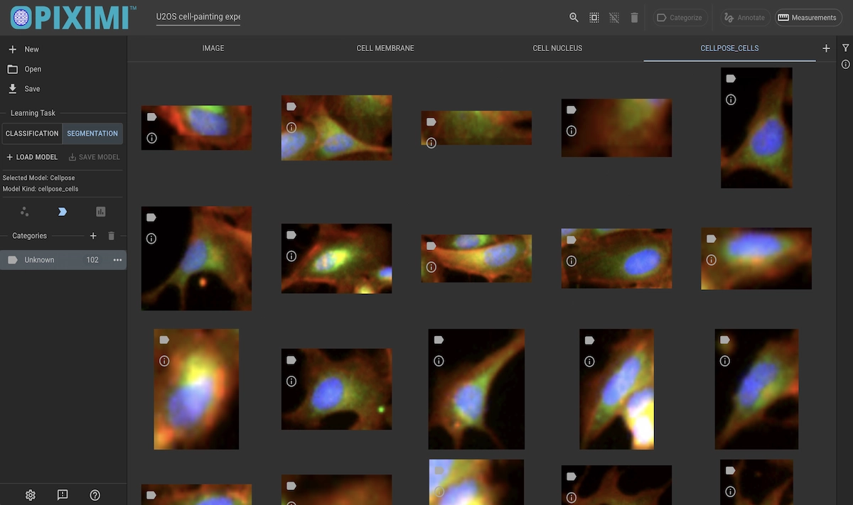 ../../_images/u20s-cellpose-results-dark.webp