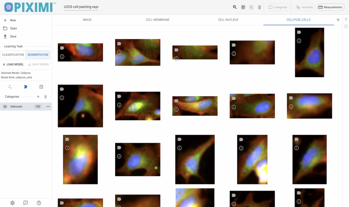 ../../_images/u20s-cellpose-results-light.webp