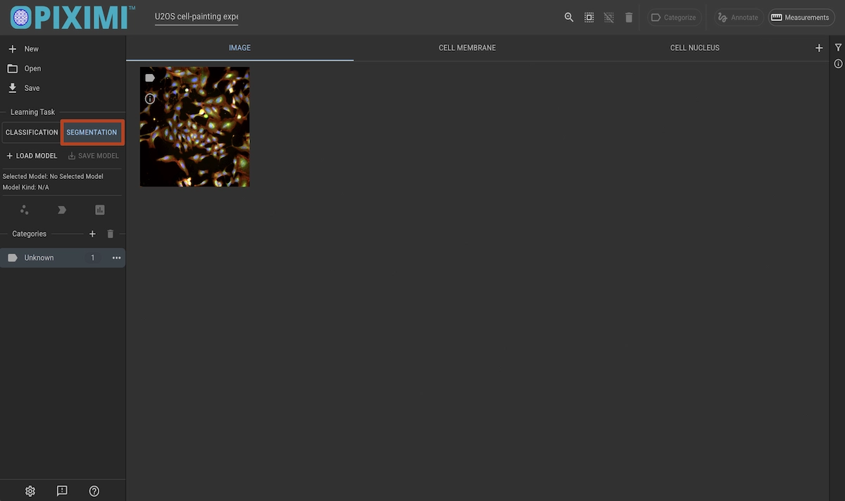 ../../_images/u20s-segmentation-dark.webp