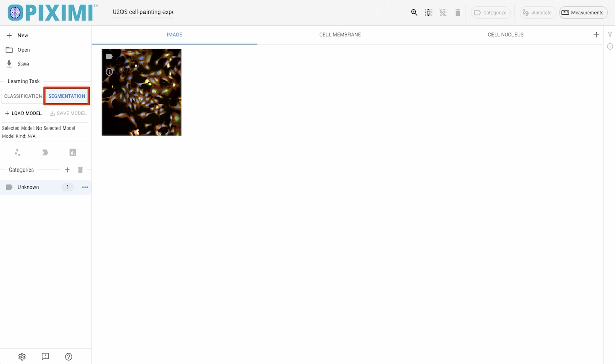 ../../_images/u20s-segmentation-light.webp