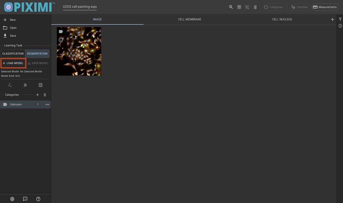 ../../_images/u20s-segmentation-load-dark.webp