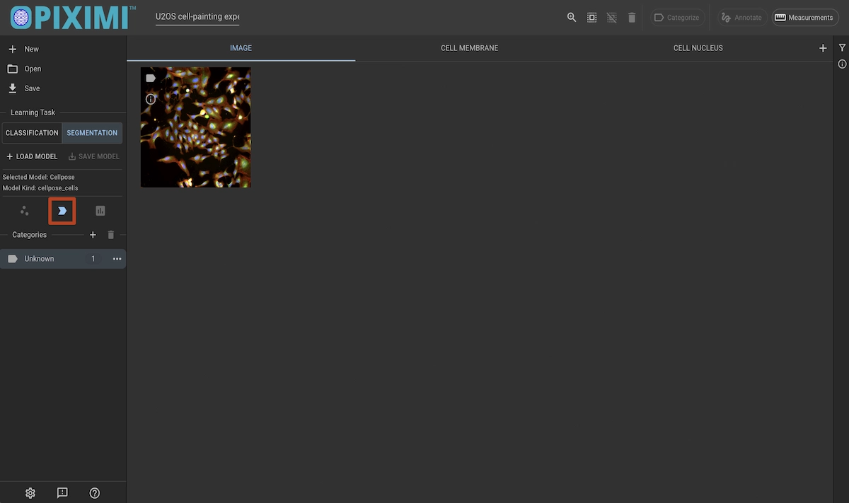 ../../_images/u20s-segmentation-predict-dark.webp